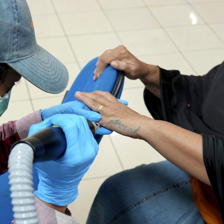 Muslims with tattoo regrets flock to a free removal service during Ramadan